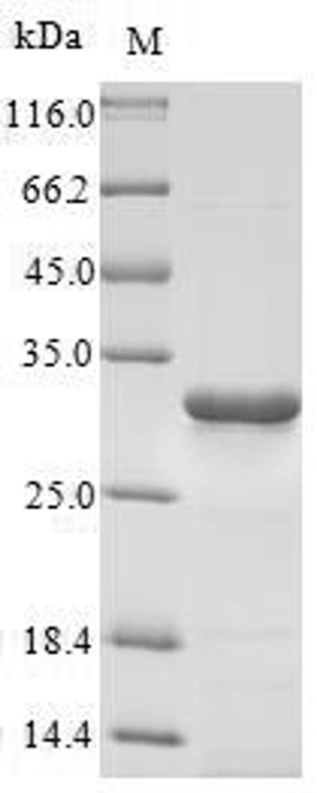 (Tris-Glycine gel) Discontinuous SDS-PAGE (reduced) with 5% enrichment gel and 15% separation gel.