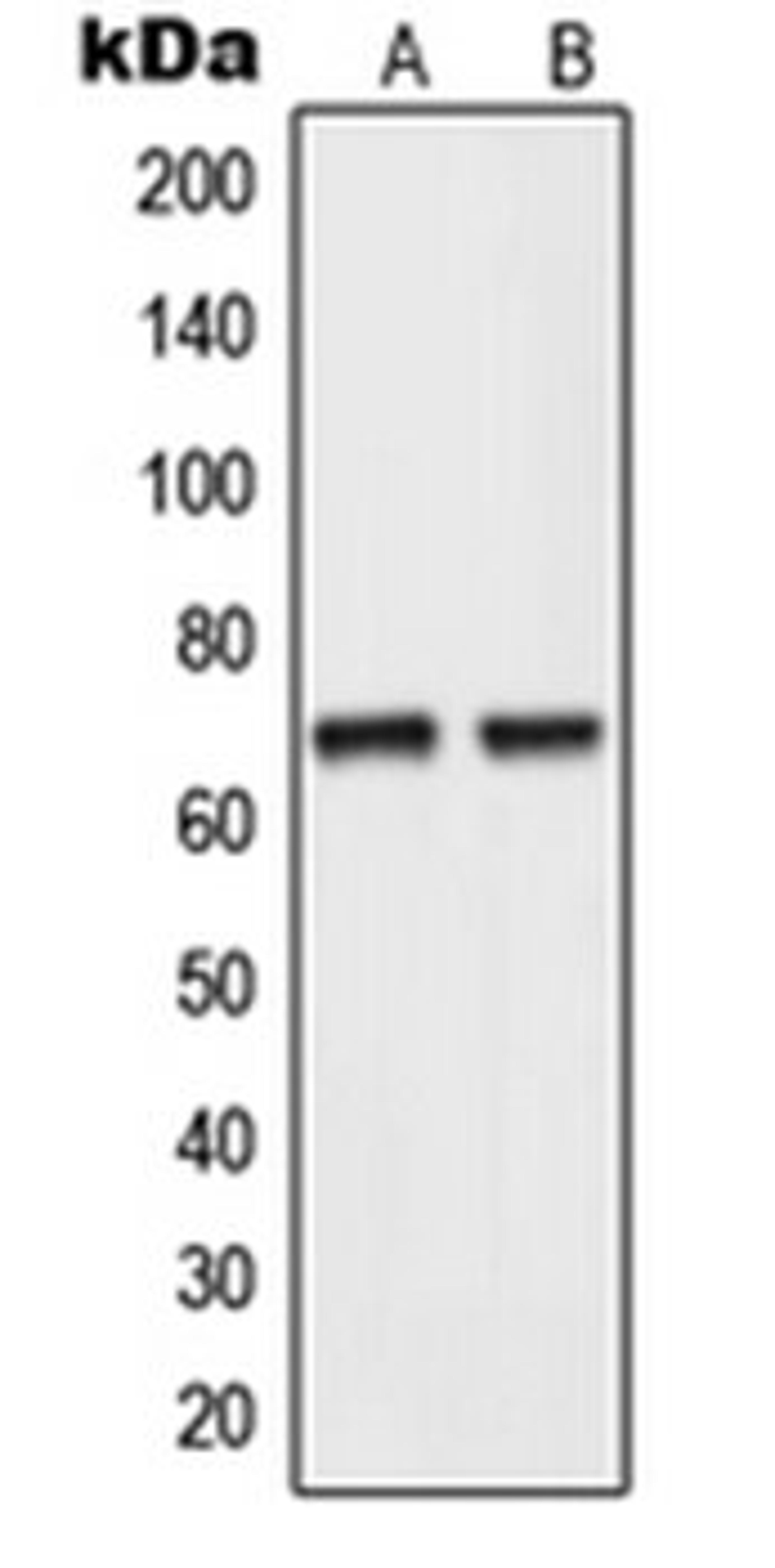 Western blot analysis of human testis (Lane 1), HepG2 (Lane 2) whole cell lysates using NEIL3 antibody