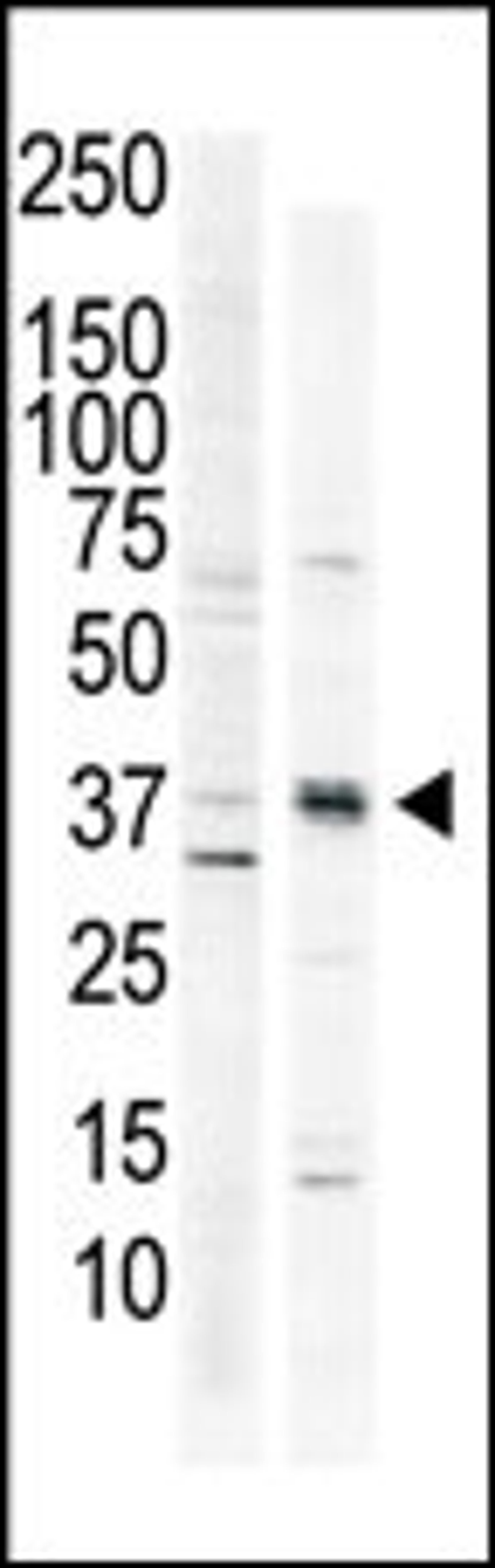 Antibody is used in Western blot to detect CAMK1 in HeLa cell lysate (lane 1) and primate brain tissue lysate (lane 2).