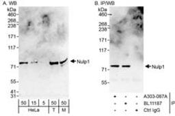 Detection of human and mouse Nulp1 by western blot (h & m) and immunoprecipitation (h).