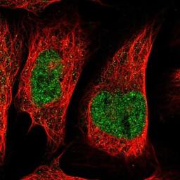 Immunocytochemistry/Immunofluorescence: C20orf177 Antibody [NBP1-94080] - Staining of human cell line U-2 OS shows positivity in nucleus but not nucleoli.