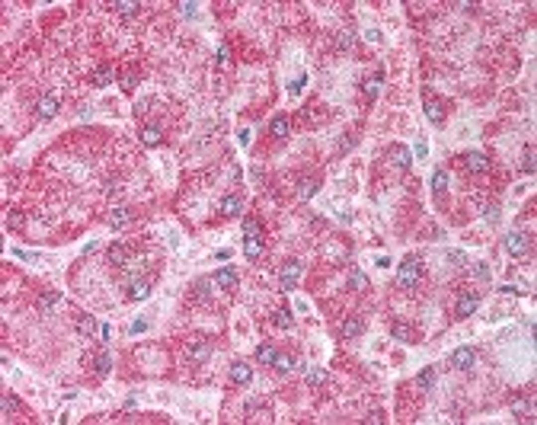 Immunohistochemistry staining of PPARG in liver tissue using PPARG Antibody.