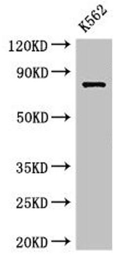 Western Blot. Positive WB detected in: K562 whole cell lysate. All lanes: IL12RB1 antibody at 3.5µg/ml. Secondary. Goat polyclonal to rabbit IgG at 1/50000 dilution. Predicted band size: 74, 73, 43 kDa. Observed band size: 74 kDa