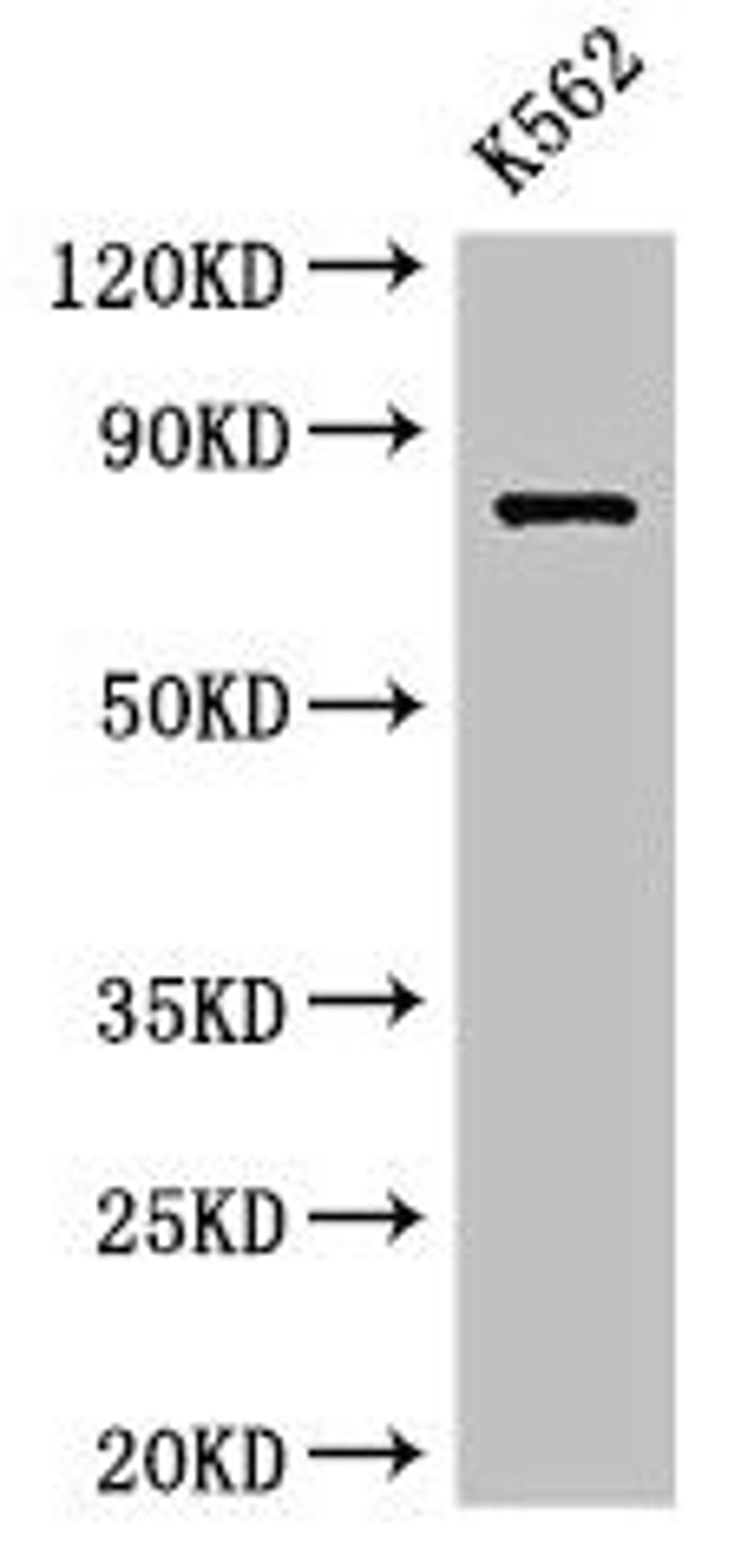 Western Blot. Positive WB detected in: K562 whole cell lysate. All lanes: IL12RB1 antibody at 3.5µg/ml. Secondary. Goat polyclonal to rabbit IgG at 1/50000 dilution. Predicted band size: 74, 73, 43 kDa. Observed band size: 74 kDa