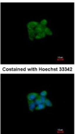 Immunocytochemistry/Immunofluorescence: SUOX Antibody [NBP1-32423] - Analysis of methanol-fixed HepG2, using antibody at 1:200 dilution.