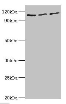 Western blot. All lanes: MERTK antibody at 8ug/ml. Lane 1: Mouse gonad tissue. Lane 2: Mouse lung tissue. Lane 3: Mouse kidney tissue. Secondary. Goat polyclonal to rabbit IgG at 1/10000 dilution. Predicted band size: 110 kDa. Observed band size: 110 kDa. 