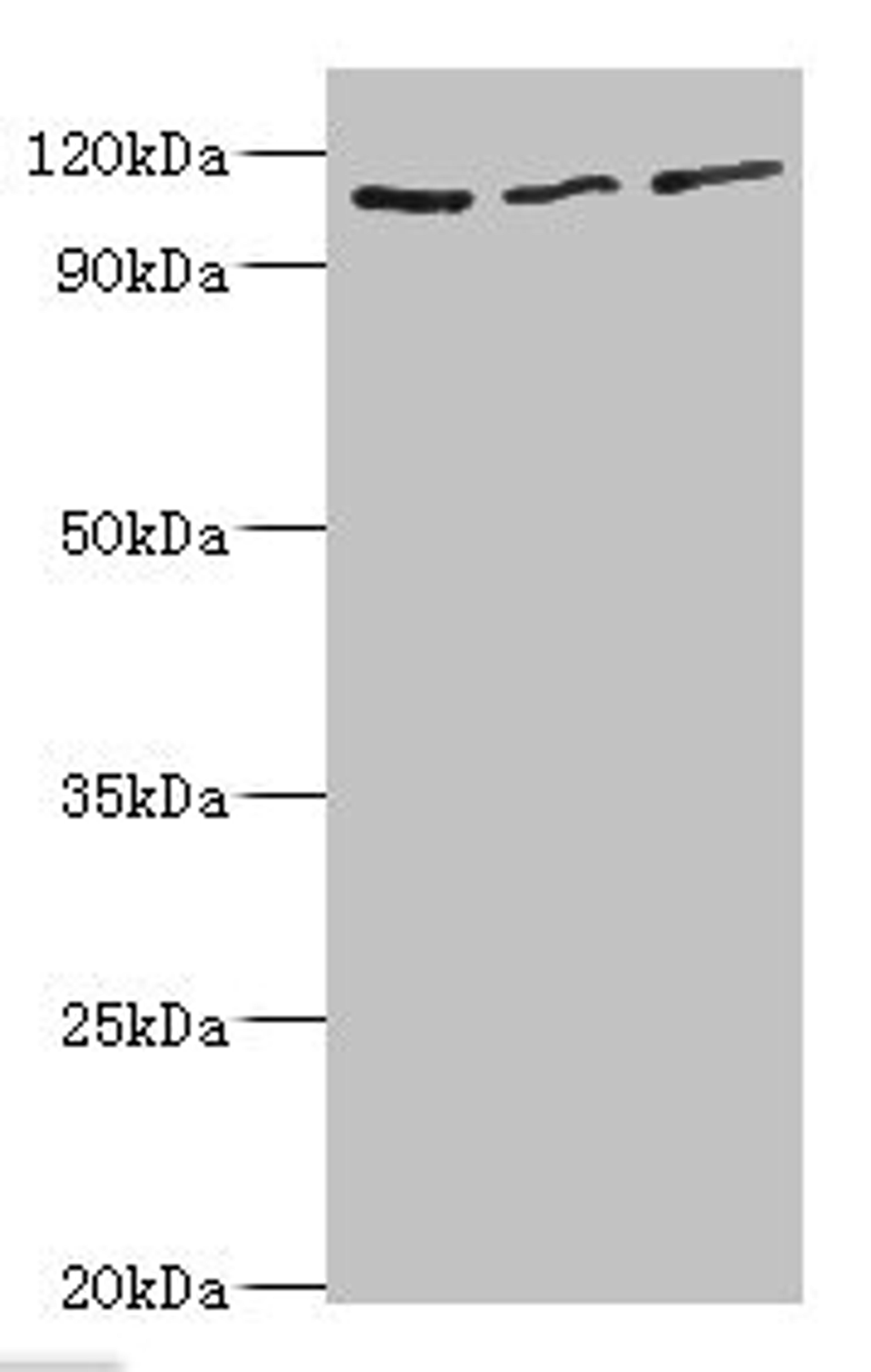 Western blot. All lanes: MERTK antibody at 8ug/ml. Lane 1: Mouse gonad tissue. Lane 2: Mouse lung tissue. Lane 3: Mouse kidney tissue. Secondary. Goat polyclonal to rabbit IgG at 1/10000 dilution. Predicted band size: 110 kDa. Observed band size: 110 kDa. 