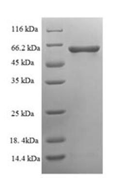 (Tris-Glycine gel) Discontinuous SDS-PAGE (reduced) with 5% enrichment gel and 15% separation gel.