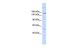 Antibody used in WB on Human 293T at 0.2-1 ug/ml.