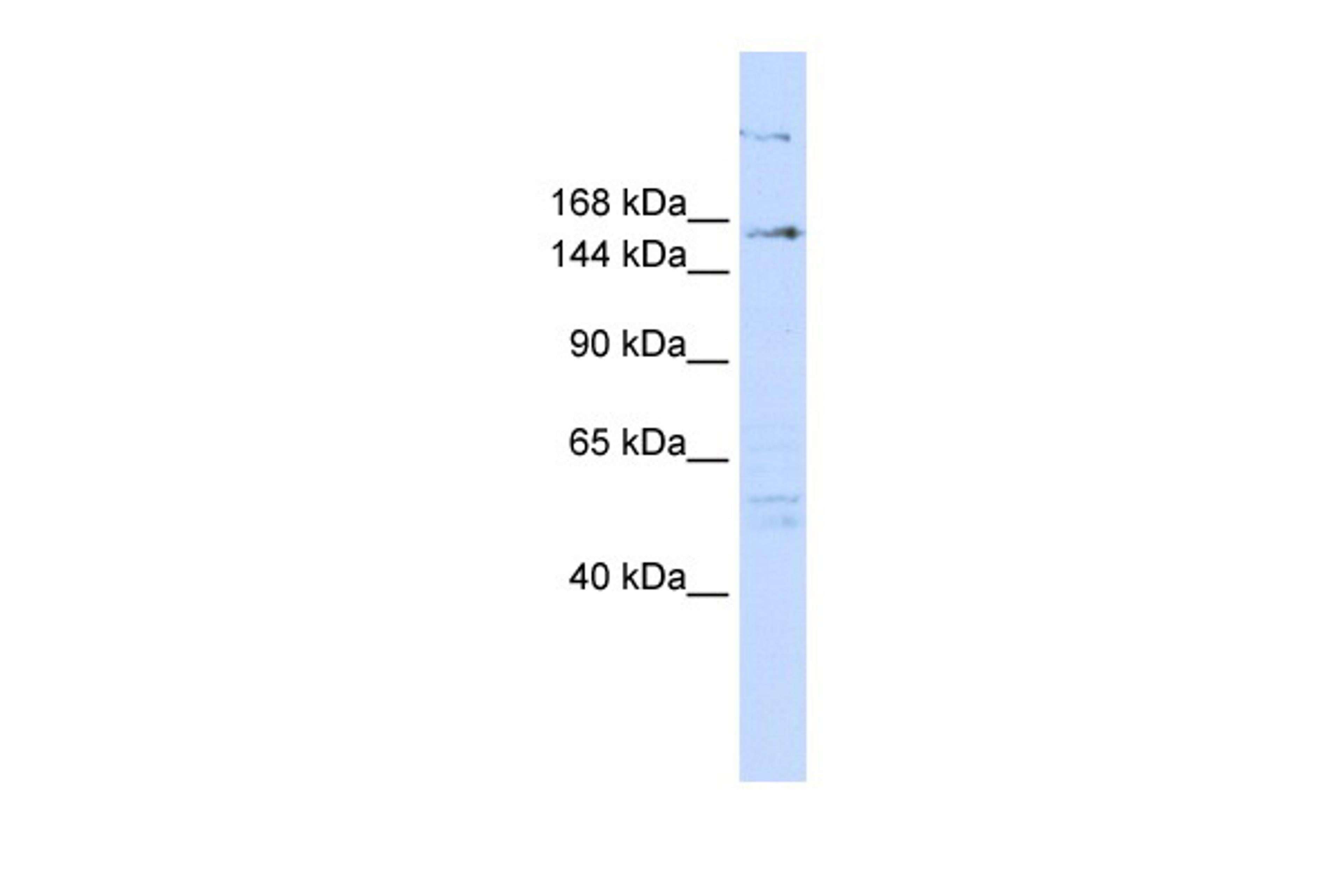 Antibody used in WB on Human 293T at 0.2-1 ug/ml.