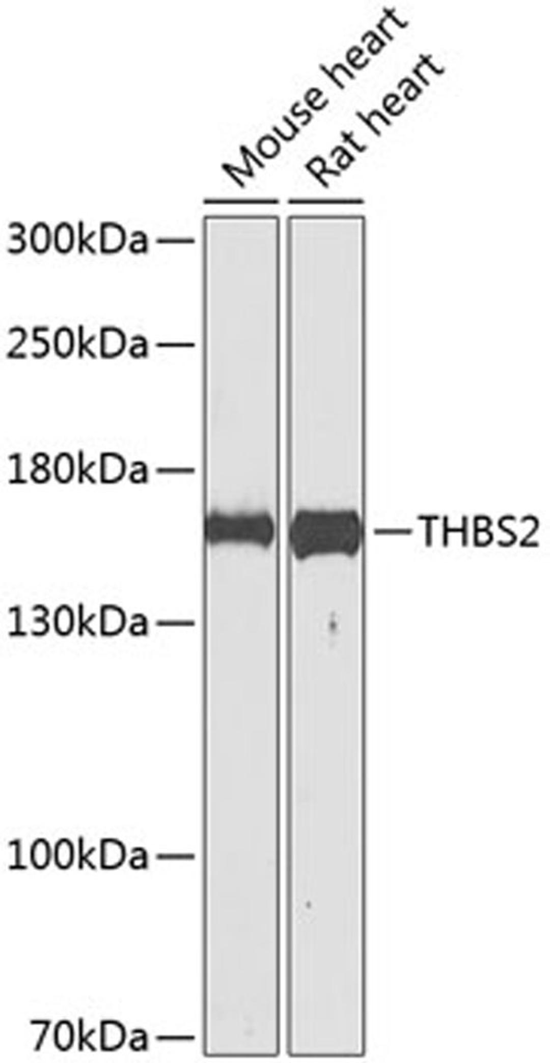 Western blot - THBS2 antibody (A8561)