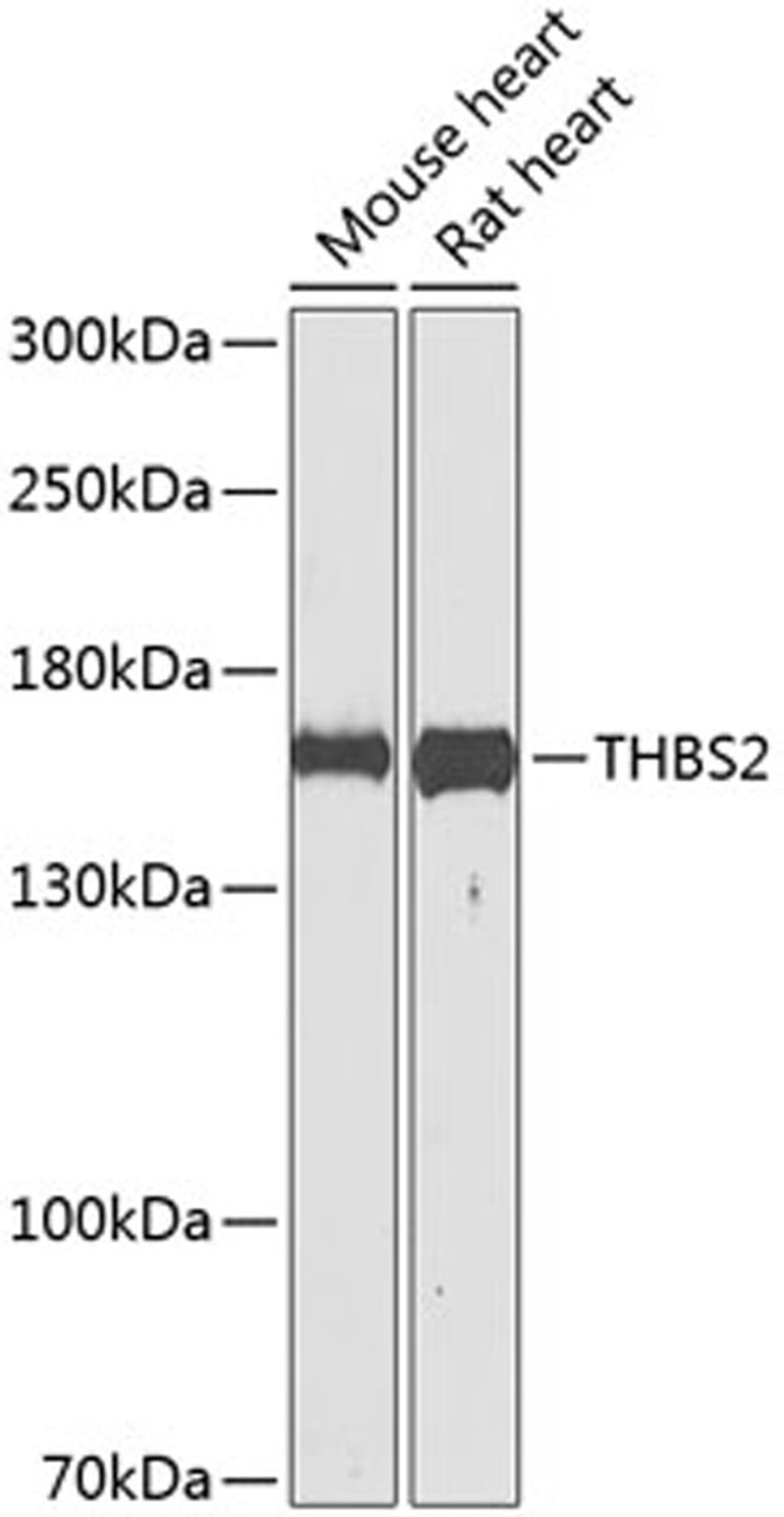 Western blot - THBS2 antibody (A8561)