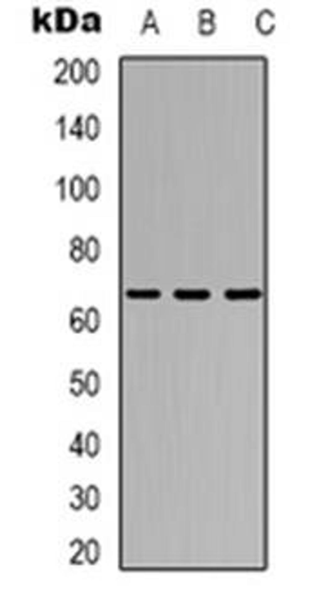 Western blot analysis of TAF5L expression in Jurkat (Lane 1), HT29 (Lane 2), COS7 (Lane 3) whole cell lysates using TAF5L antibody