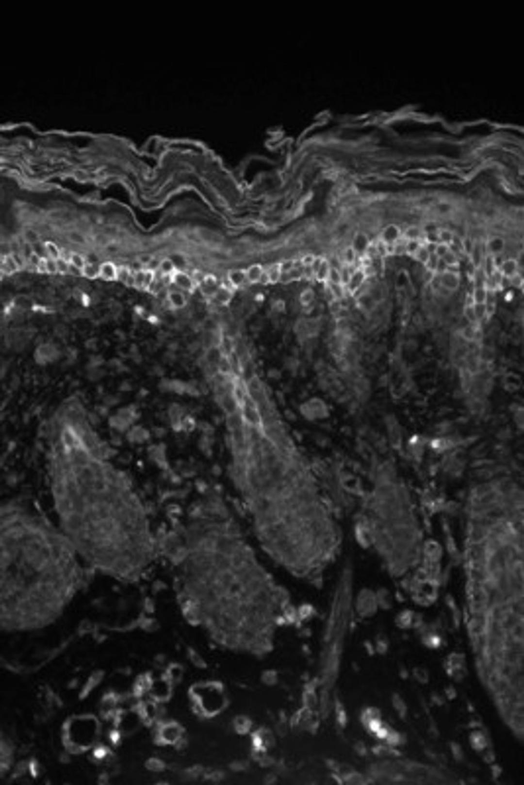 Immunohistochemistry: Kv1.1 Antibody (S20-78) [NBP1-48305] - mouse backskin sections. Courtesy of Dr. Turksen, Ottawa Hospital Research Institute, Canada.