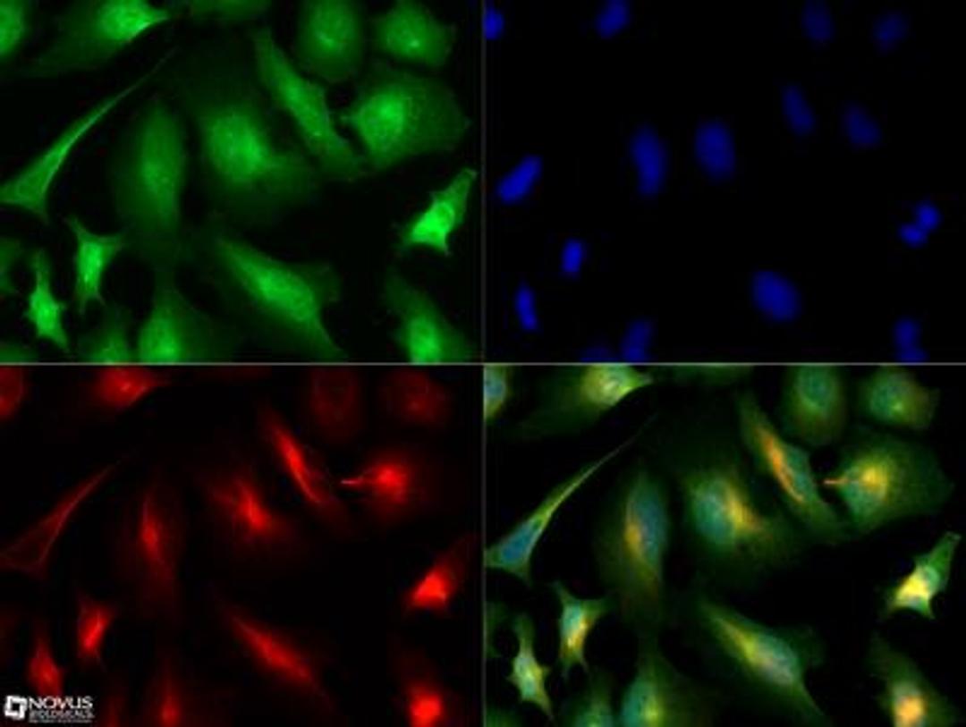 Immunocytochemistry/Immunofluorescence: PCSK9 Antibody [NBP2-31364] - PCSK9 antibody was tested in HeLa cells with Dylight 488 (green). Nuclei and alpha-tubulin were counterstained with DAPI (blue) and Dylight 550 (red). A concentration of 0.1 ug/ml was used. Image objective 40x.