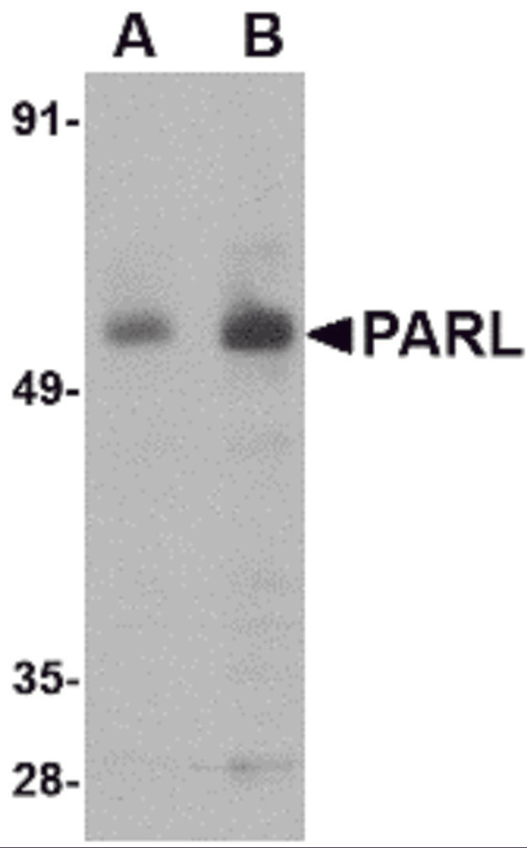 Western blot analysis of PARL in 3T3 cell lysate with PARL antibody at (A) 1 and (B) 2 μg/mL.