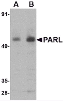 Western blot analysis of PARL in 3T3 cell lysate with PARL antibody at (A) 1 and (B) 2 μg/mL.