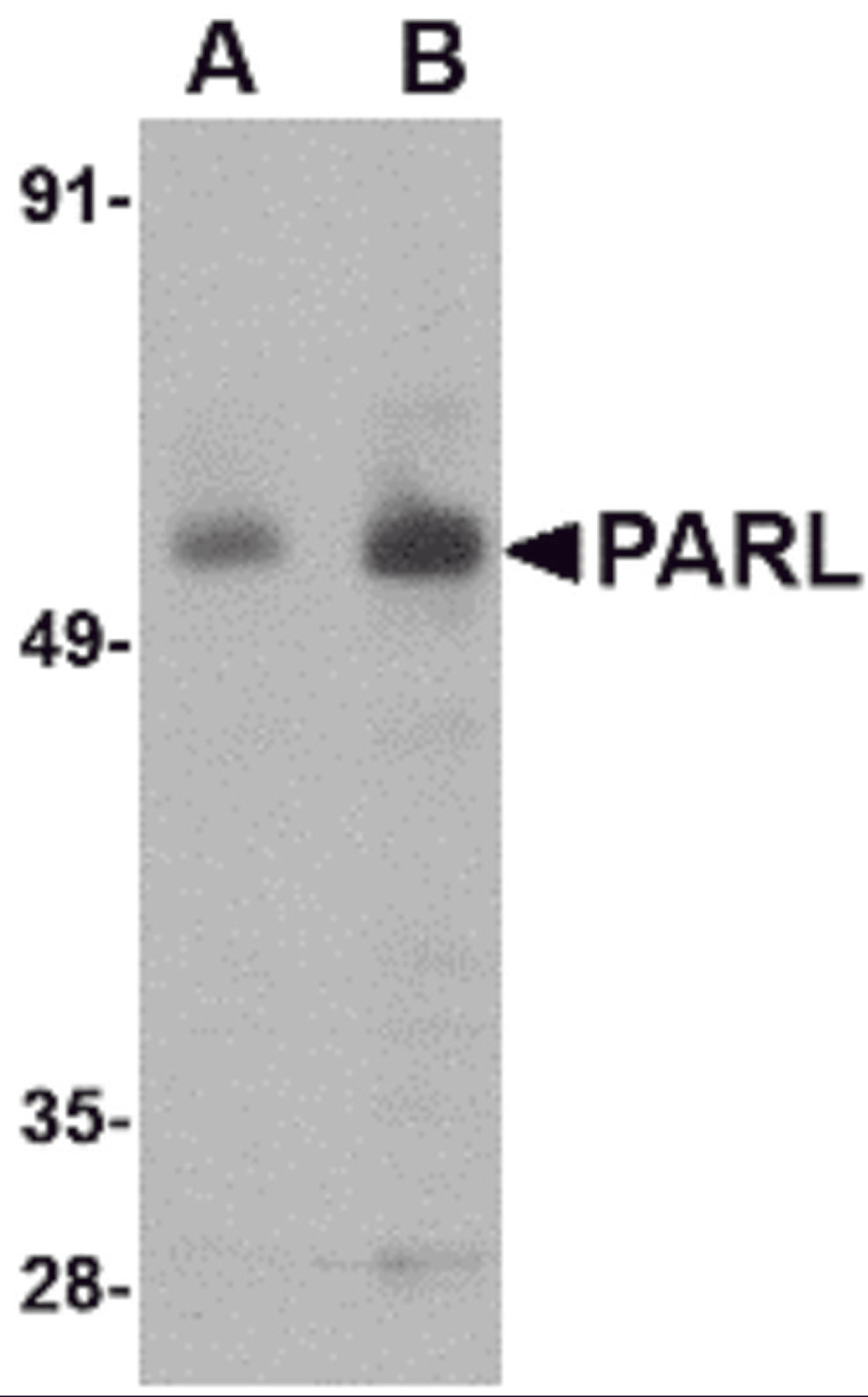 Western blot analysis of PARL in 3T3 cell lysate with PARL antibody at (A) 1 and (B) 2 μg/mL.