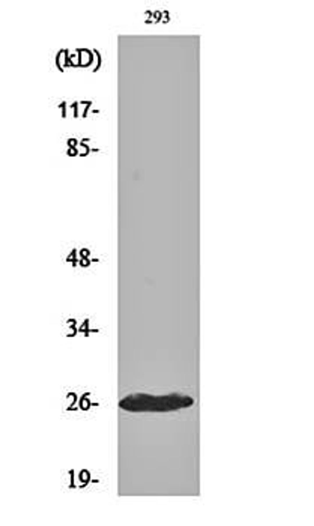 Western blot analysis of 293 cell lysates using Cleaved-C1r LC (I464) antibody