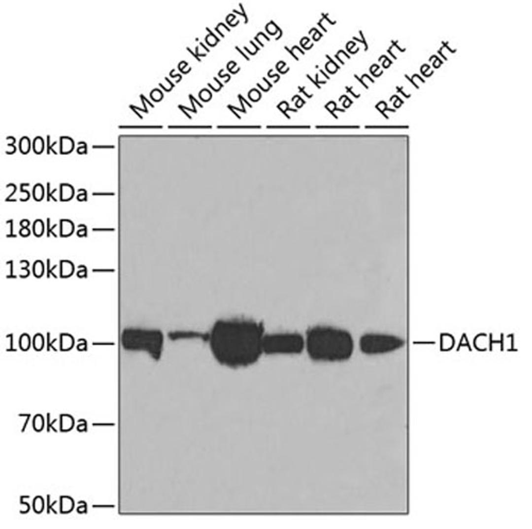 Western blot - DACH1 antibody (A6895)