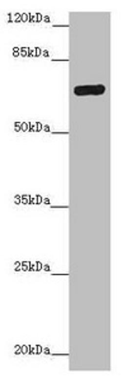Western blot. All lanes: ZNF20 antibody at 2.99ug/ml + Mouse kidney tissue. Secondary. Goat polyclonal to rabbit IgG at 1/10000 dilution. Predicted band size: 62 kDa. Observed band size: 62 kDa. 