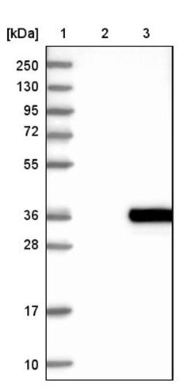 Western Blot: HDGFRP3 Antibody [NBP2-13246] - Lane 1: Marker [kDa] 250, 130, 95, 72, 55, 36, 28, 17, 10<br/>Lane 2: Negative control (vector only transfected HEK293T lysate)<br/>Lane 3: Over-expression lysate (Co-expressed with a C-terminal myc-DDK tag (~3.1 kDa) in mammalian HEK293T cells, LY402497)