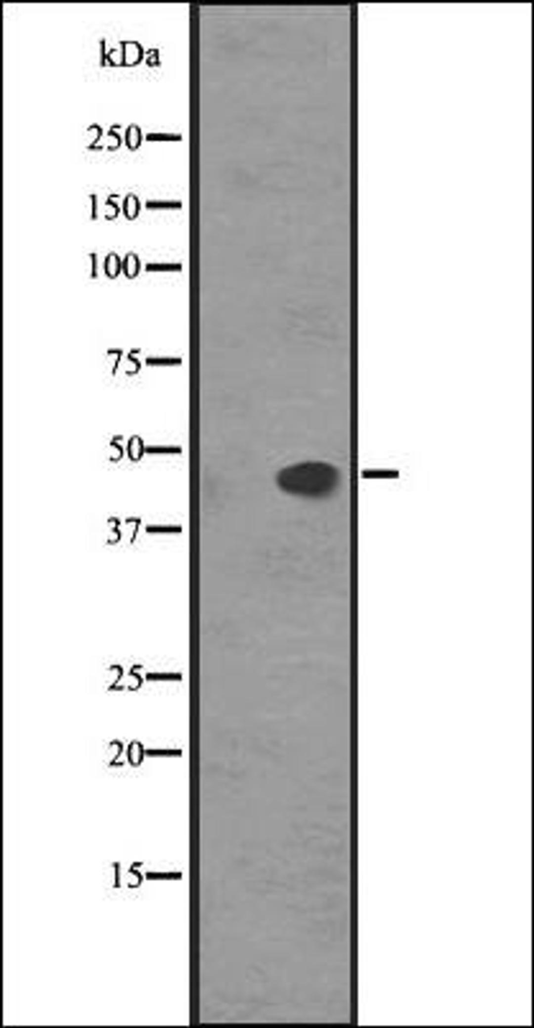 Western blot analysis of HEK293 cells using SS5R antibody