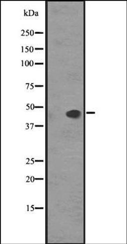 Western blot analysis of HEK293 cells using SS5R antibody