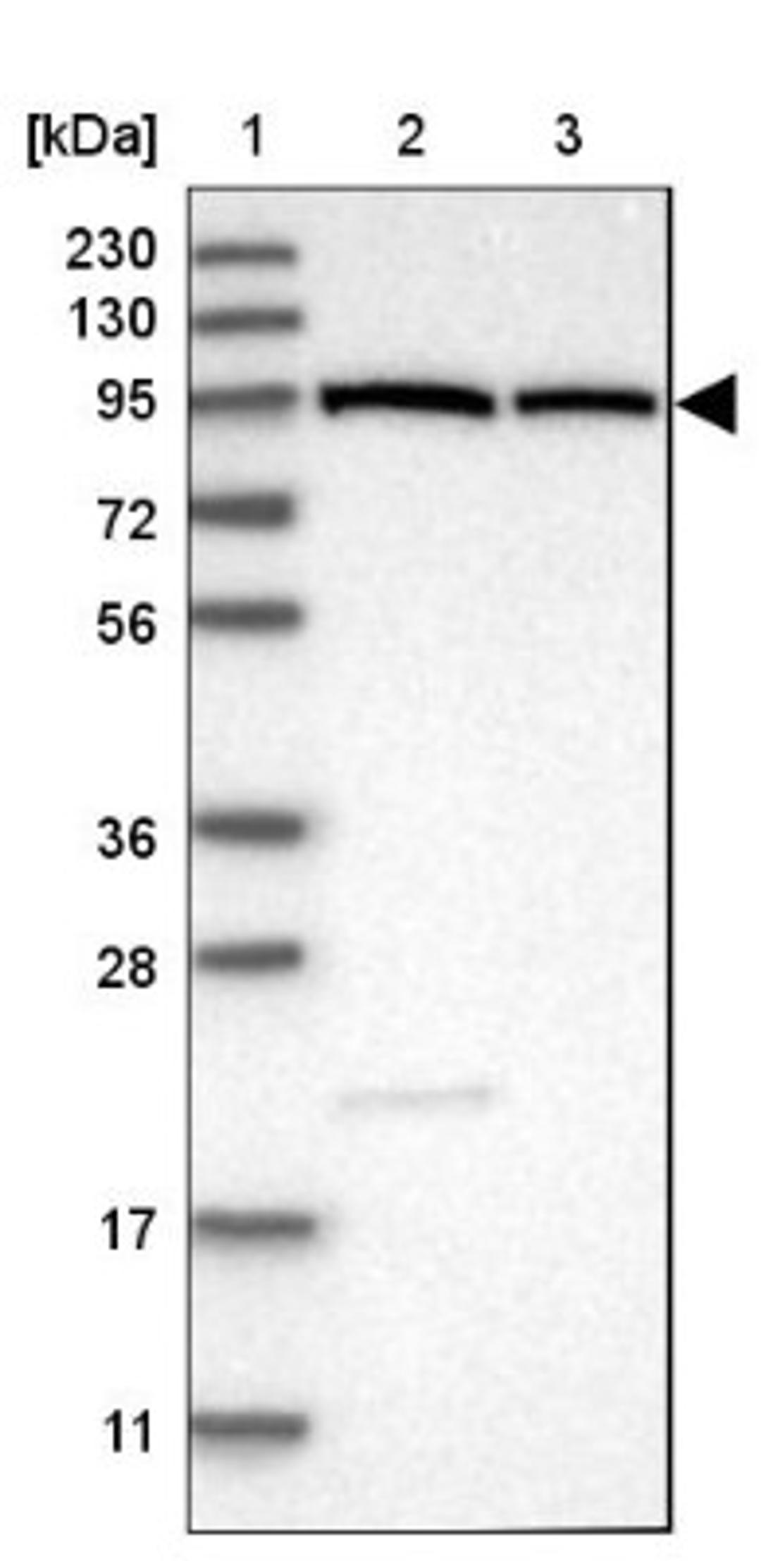 Western Blot: ZNF788 Antibody [NBP2-47562] - Lane 1: Marker [kDa] 230, 130, 95, 72, 56, 36, 28, 17, 11.  Lane 2: Human cell line RT-4.  Lane 3: Human cell line U-251MG.