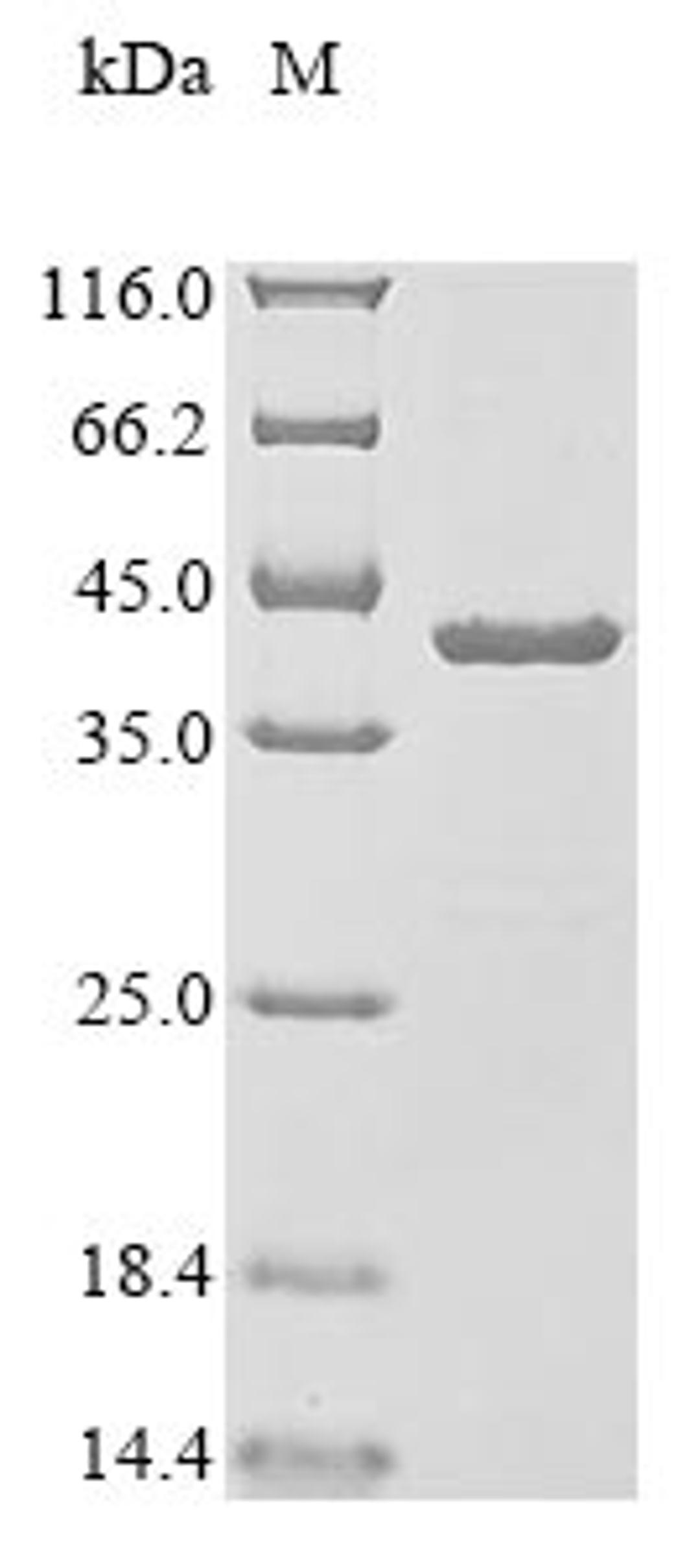 (Tris-Glycine gel) Discontinuous SDS-PAGE (reduced) with 5% enrichment gel and 15% separation gel.