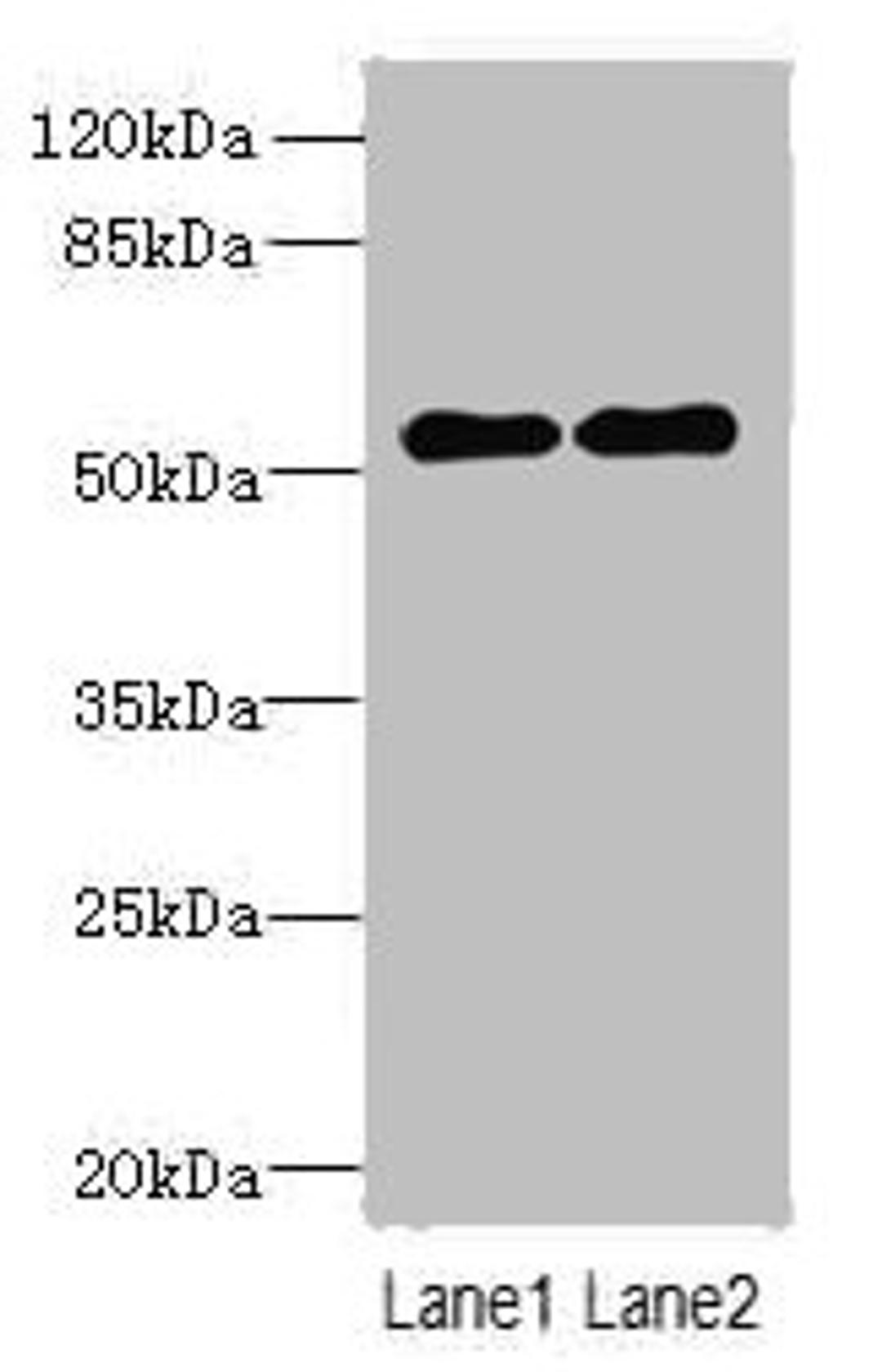 Western blot. All lanes: TRMT6 antibody at 4ug/ml. Lane 1: U251 whole cell lysate. Lane 2: HepG2 whole cell lysate. Secondary. Goat polyclonal to rabbit IgG at 1/10000 dilution. Predicted band size: 56, 45, 41, 37 kDa. Observed band size: 56 kDa. 
