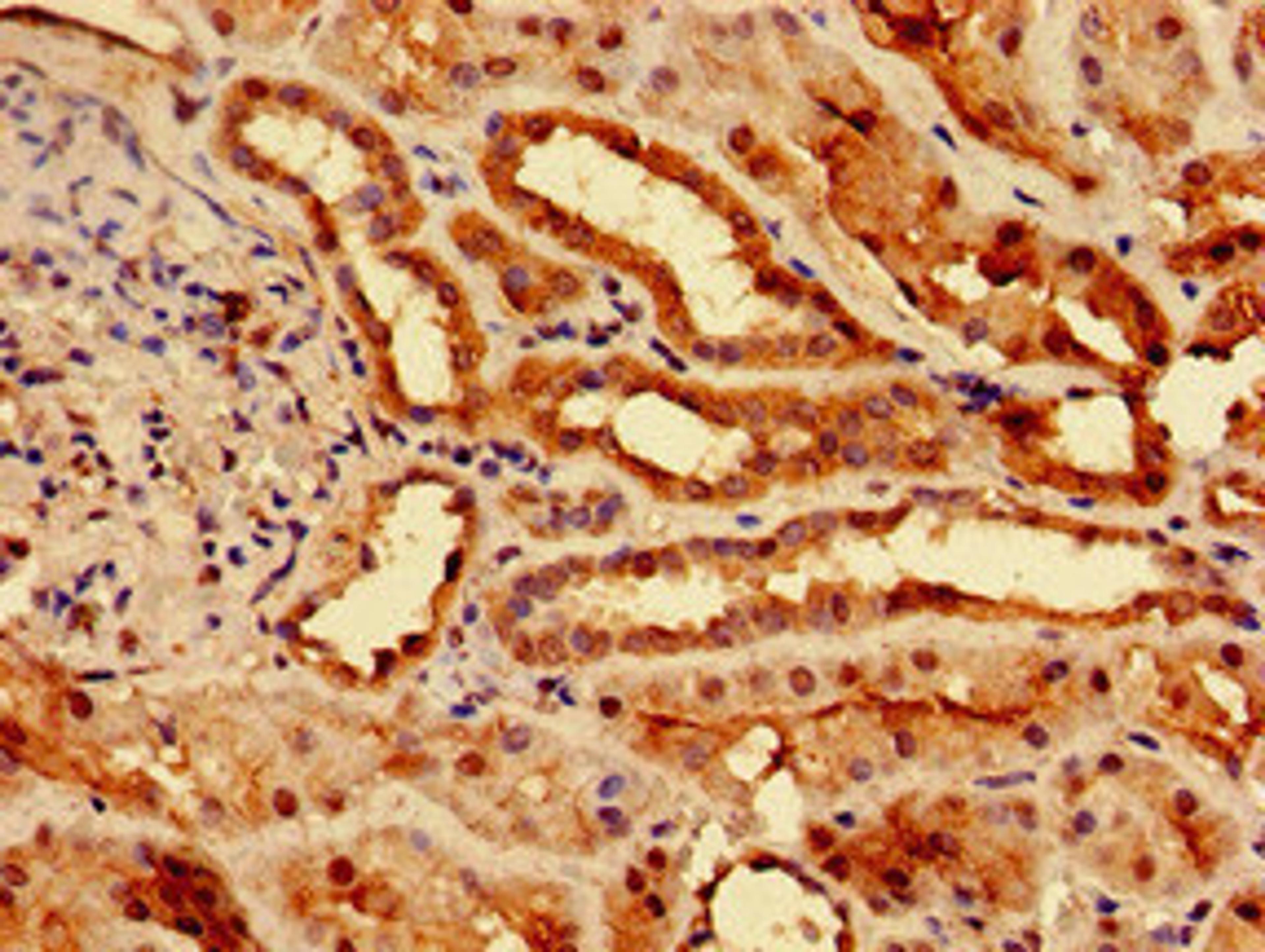 Immunohistochemistry of paraffin-embedded human kidney tissue using CSB-PA021475LA01HU at dilution of 1:100