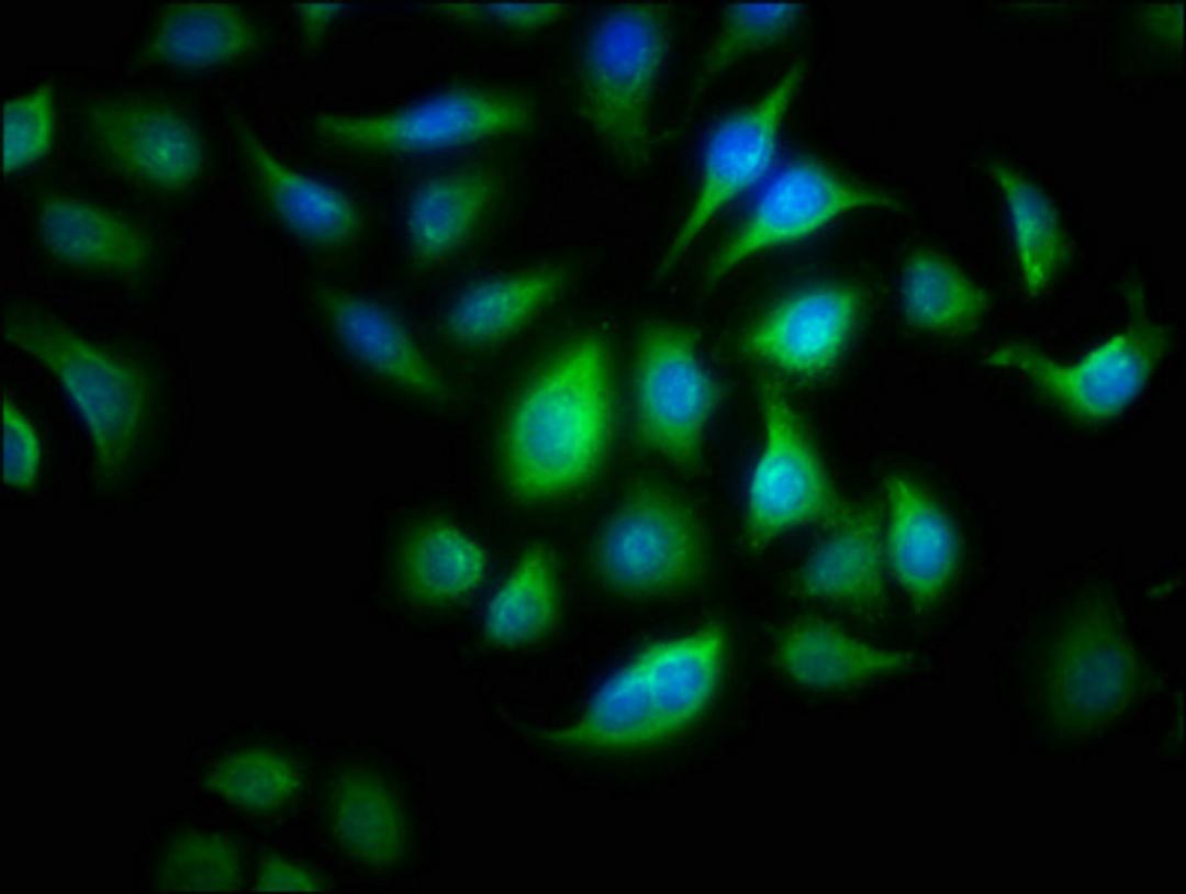 Immunofluorescence staining of A549 cells with CSB-PA001622LA01HU at 1:166, counter-stained with DAPI. The cells were fixed in 4% formaldehyde, permeabilized using 0.2% Triton X-100 and blocked in 10% normal Goat Serum. The cells were then incubated with the antibody overnight at 4&deg;C. The secondary antibody was Alexa Fluor 488-congugated AffiniPure Goat Anti-Rabbit IgG(H+L).
