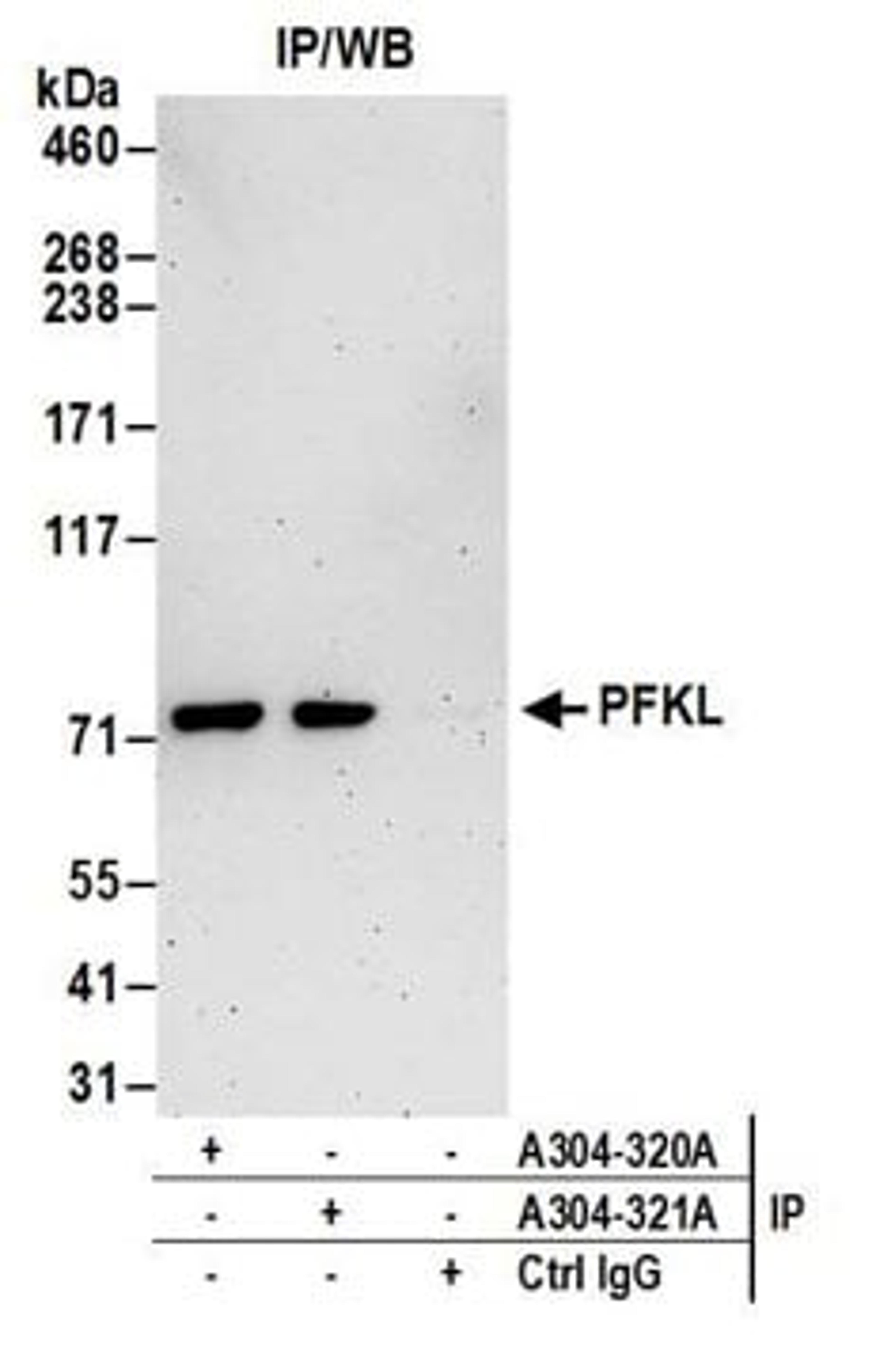 Detection of human PFKL by western blot of immunoprecipitates.