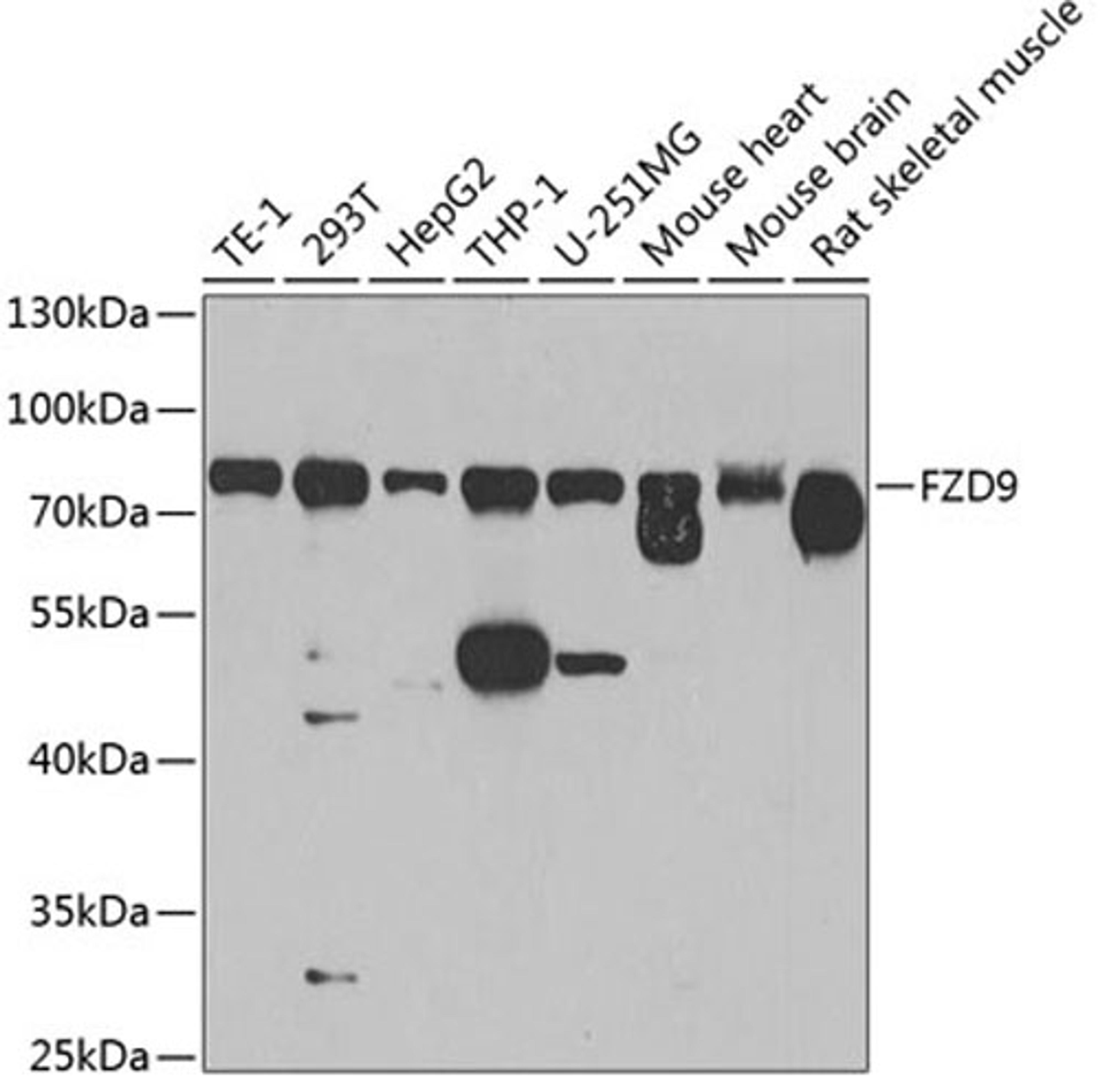 Western blot - FZD9 antibody (A8311)