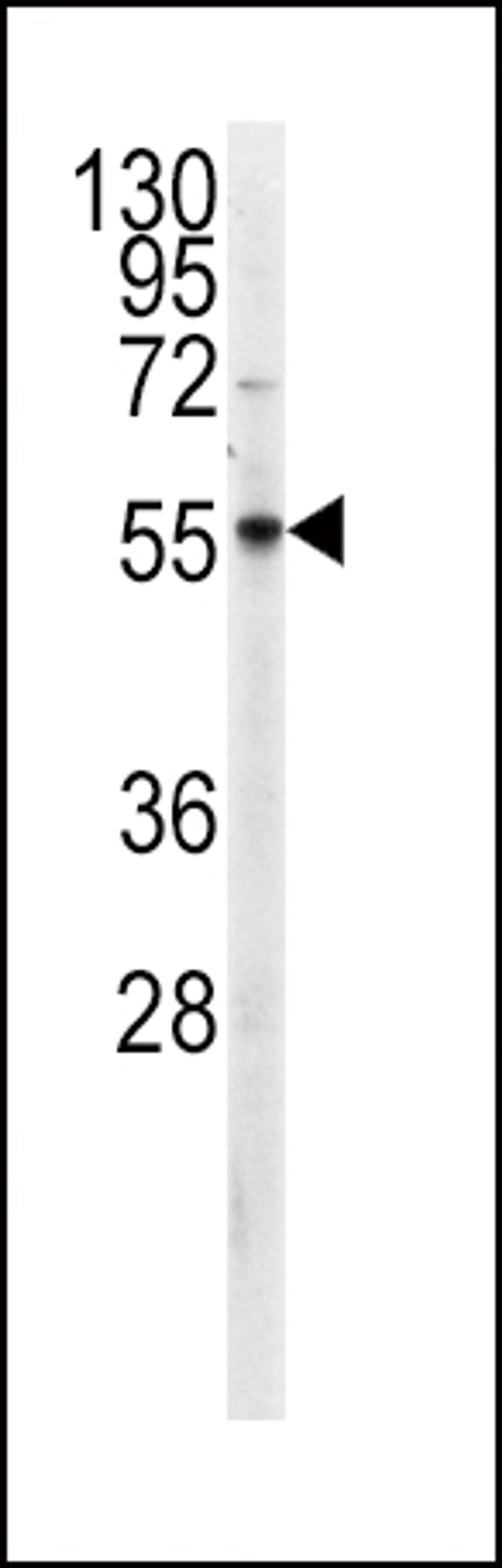 Western blot analysis of anti in CEM cell line lysates (35ug/lane)