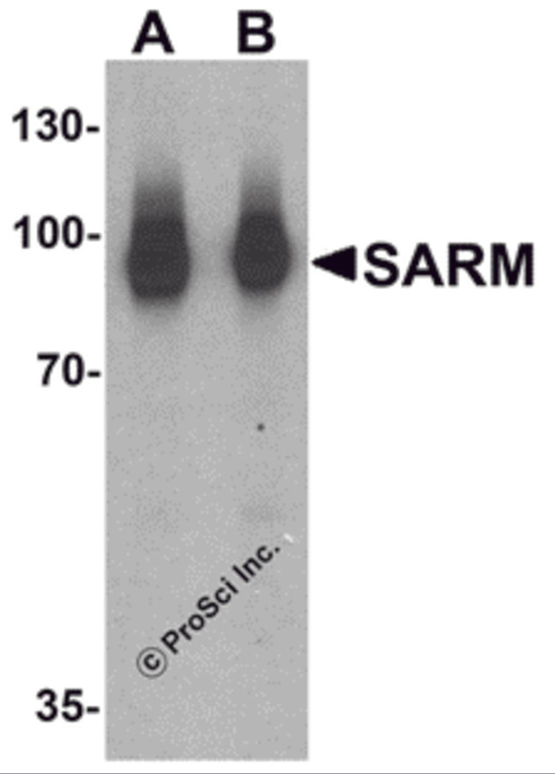 Western blot analysis of SARM in Daudi cell lysate with SARM antibody at (A) 1 and (B) 2 μg/mL.
