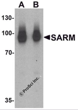 Western blot analysis of SARM in Daudi cell lysate with SARM antibody at (A) 1 and (B) 2 μg/mL.