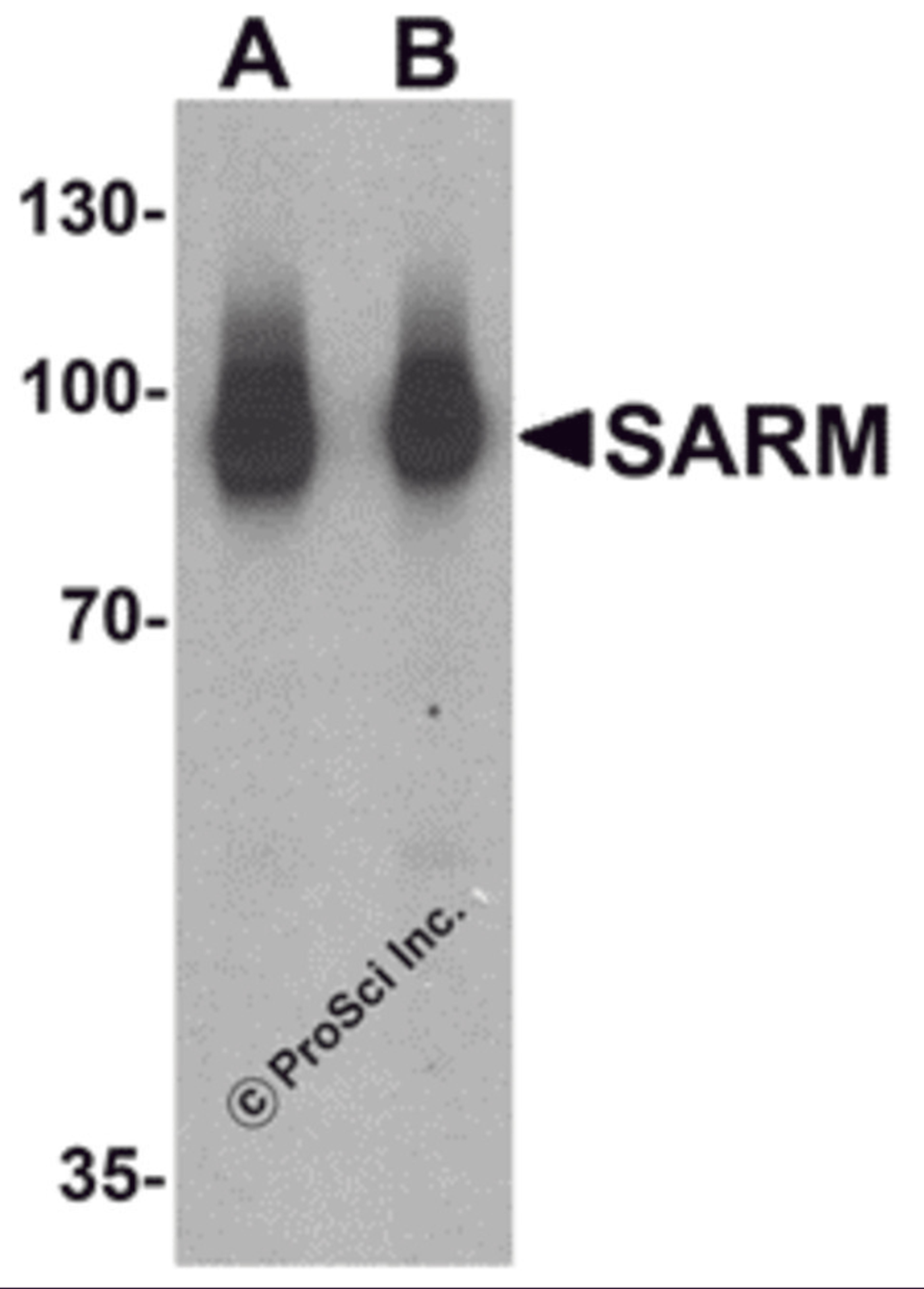 Western blot analysis of SARM in Daudi cell lysate with SARM antibody at (A) 1 and (B) 2 μg/mL.