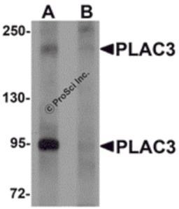 Western blot analysis of PLAC3 in HeLa cell lysate with PLAC3 antibody at 1 μg/mL in (A) the absence and (B) the presence of blocking peptide.