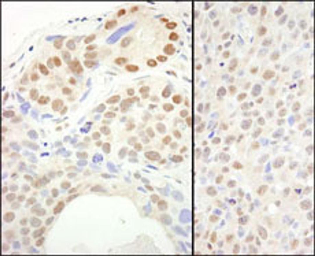 Detection of human and mouse SUPT6H by immunohistochemistry.