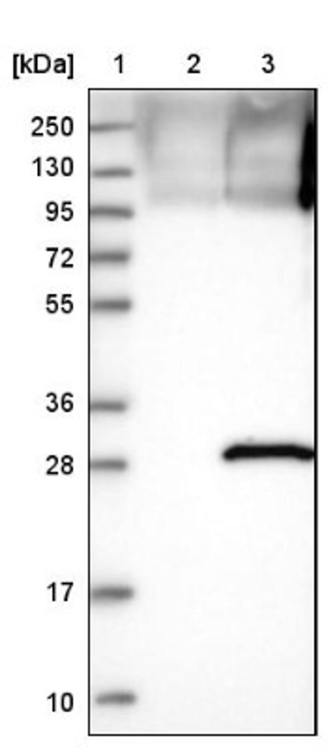 Western Blot: SENP8 Antibody [NBP1-85259] - Lane 1: Marker [kDa] 250, 130, 95, 72, 55, 36, 28, 17, 10<br/>Lane 2: Negative control (vector only transfected HEK293T lysate)<br/>Lane 3: Over-expression lysate (Co-expressed with a C-terminal myc-DDK tag (~3.1 kDa) in mammalian HEK293T cells, LY407943)