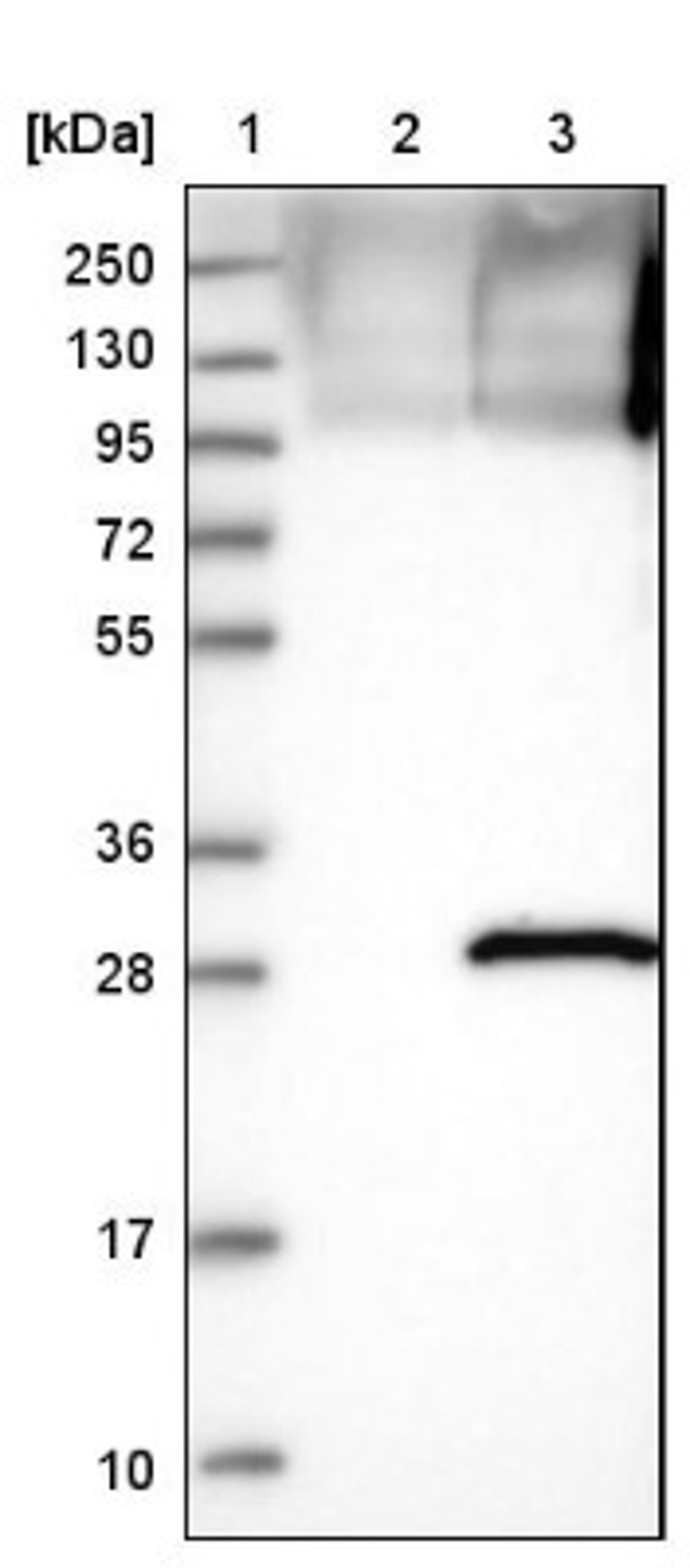 Western Blot: SENP8 Antibody [NBP1-85259] - Lane 1: Marker [kDa] 250, 130, 95, 72, 55, 36, 28, 17, 10<br/>Lane 2: Negative control (vector only transfected HEK293T lysate)<br/>Lane 3: Over-expression lysate (Co-expressed with a C-terminal myc-DDK tag (~3.1 kDa) in mammalian HEK293T cells, LY407943)