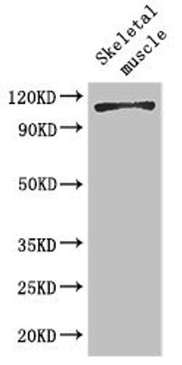 Western Blot. Positive WB detected in: Mouse skeletal muscle tissue. All lanes: EPHB6 antibody at 2ug/ml. Secondary. Goat polyclonal to rabbit IgG at 1/50000 dilution. Predicted band size: 111, 82, 58 kDa. Observed band size: 111 kDa.
