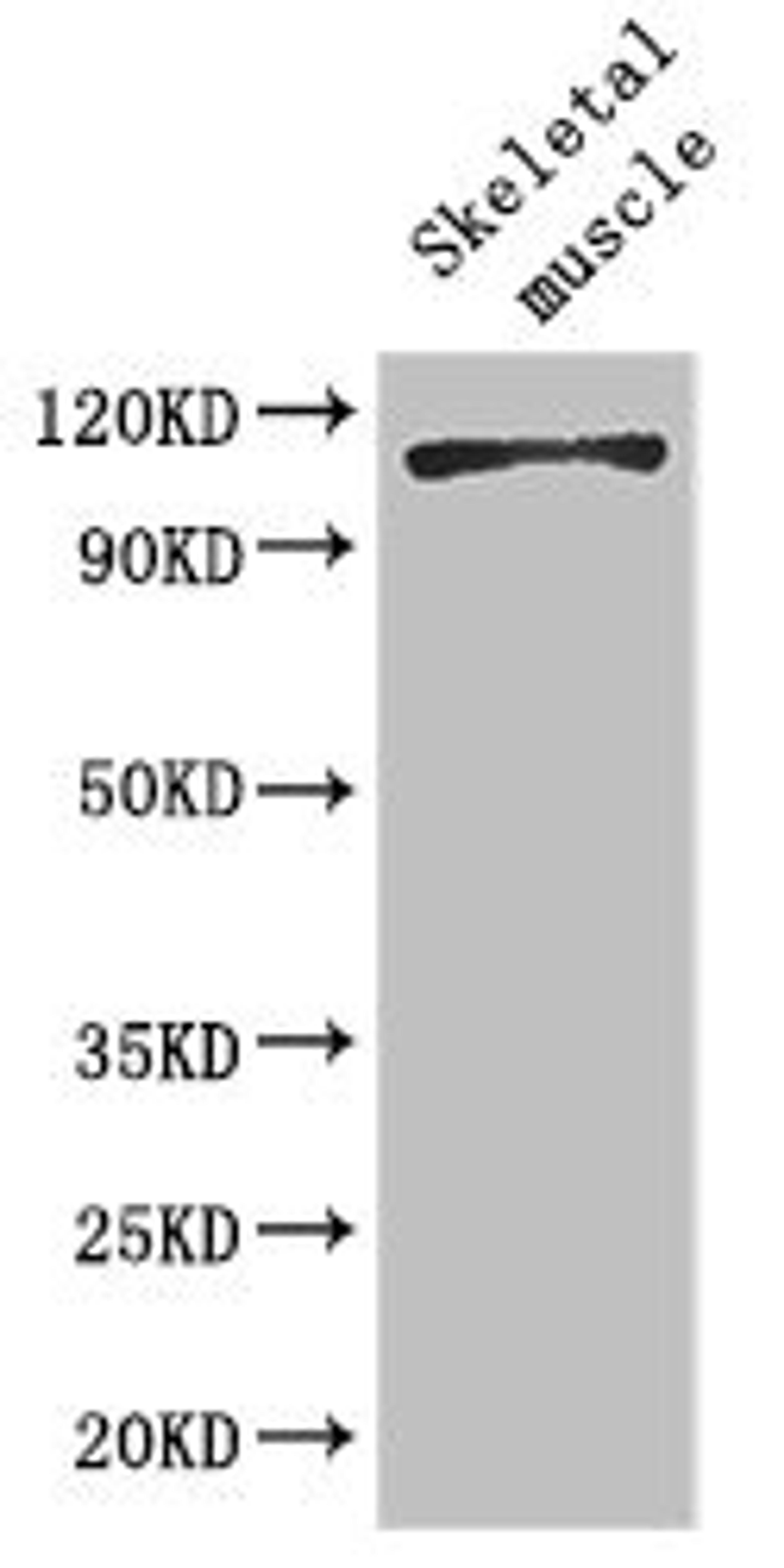 Western Blot. Positive WB detected in: Mouse skeletal muscle tissue. All lanes: EPHB6 antibody at 2ug/ml. Secondary. Goat polyclonal to rabbit IgG at 1/50000 dilution. Predicted band size: 111, 82, 58 kDa. Observed band size: 111 kDa.