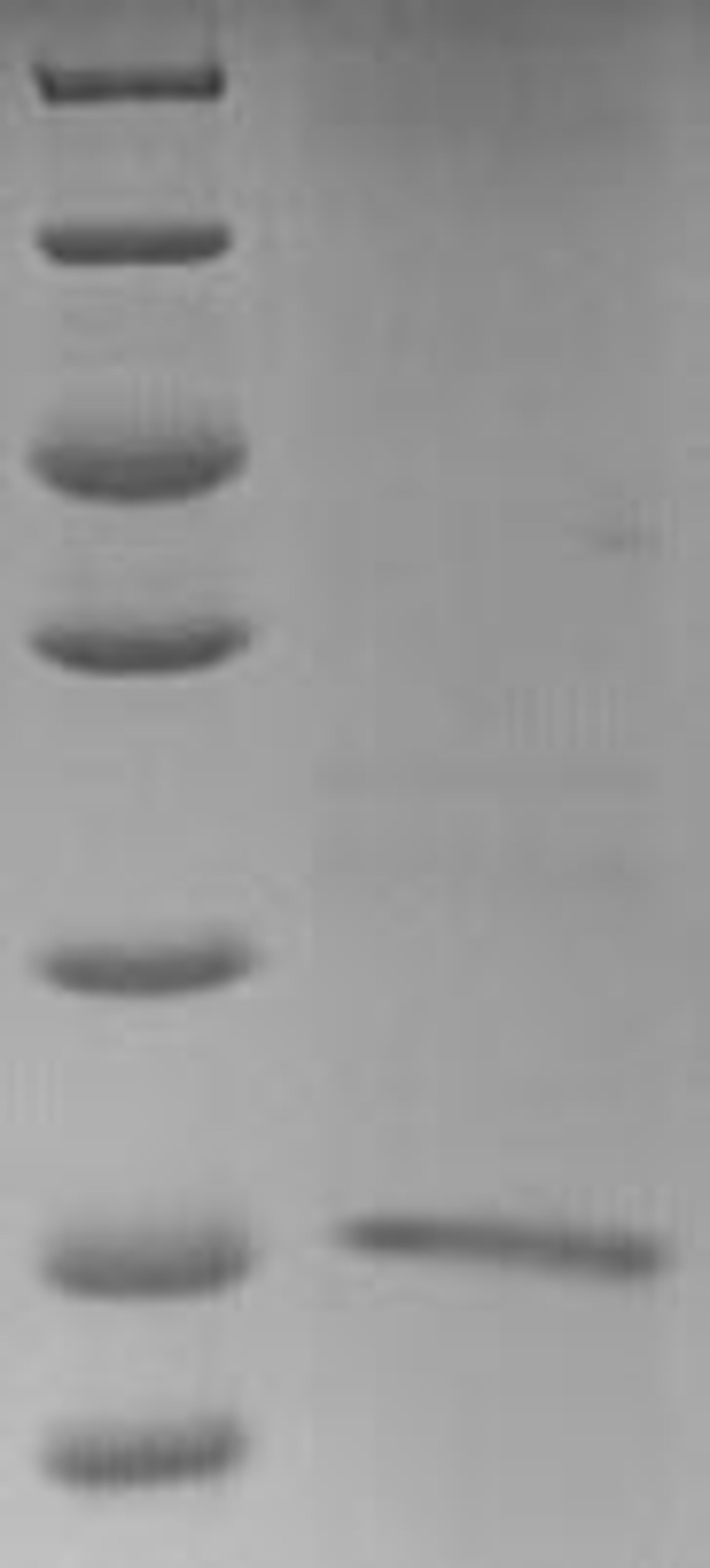(Tris-Glycine gel) Discontinuous SDS-PAGE (reduced) with 5% enrichment gel and 15% separation gel.