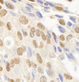 Detection of human JHDM1A immunohistochemistry.