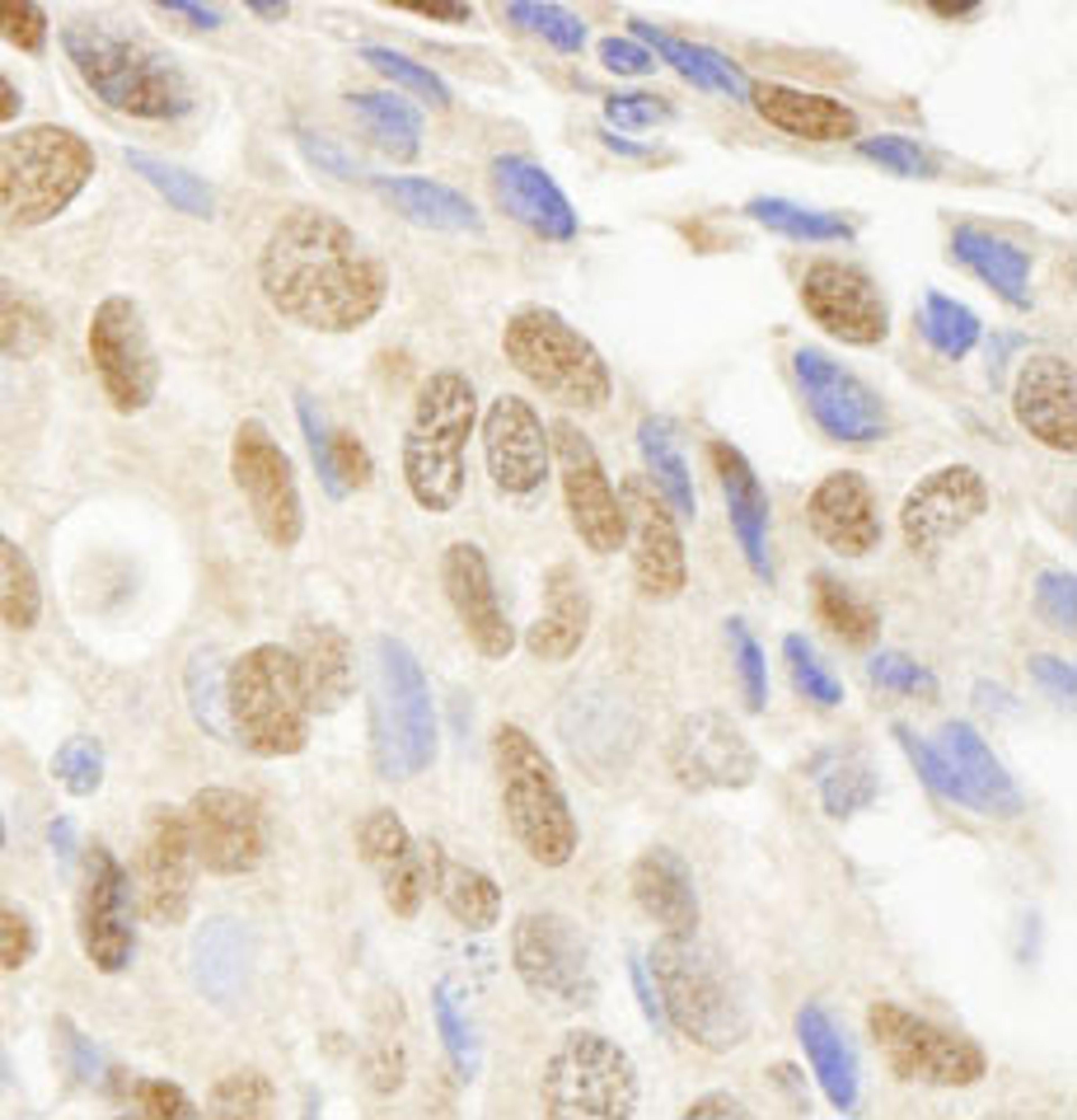 Detection of human JHDM1A immunohistochemistry.