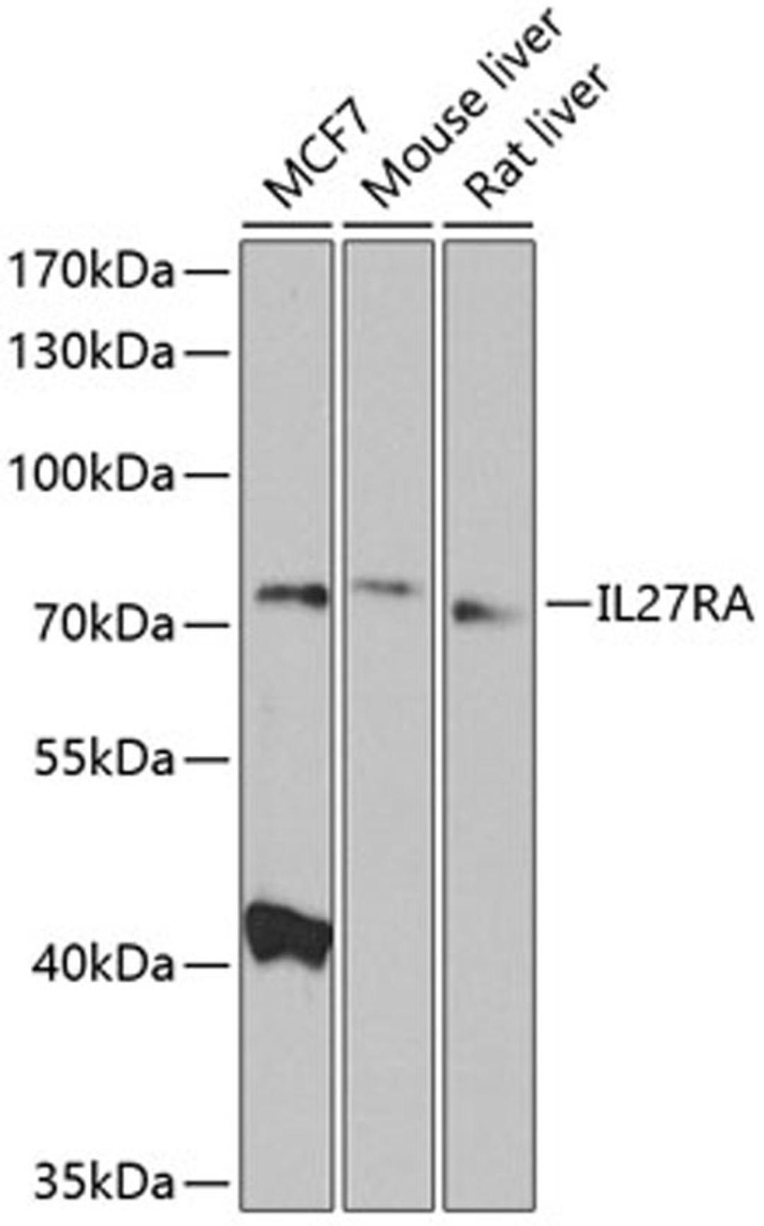 Western blot - IL27RA antibody (A8176)