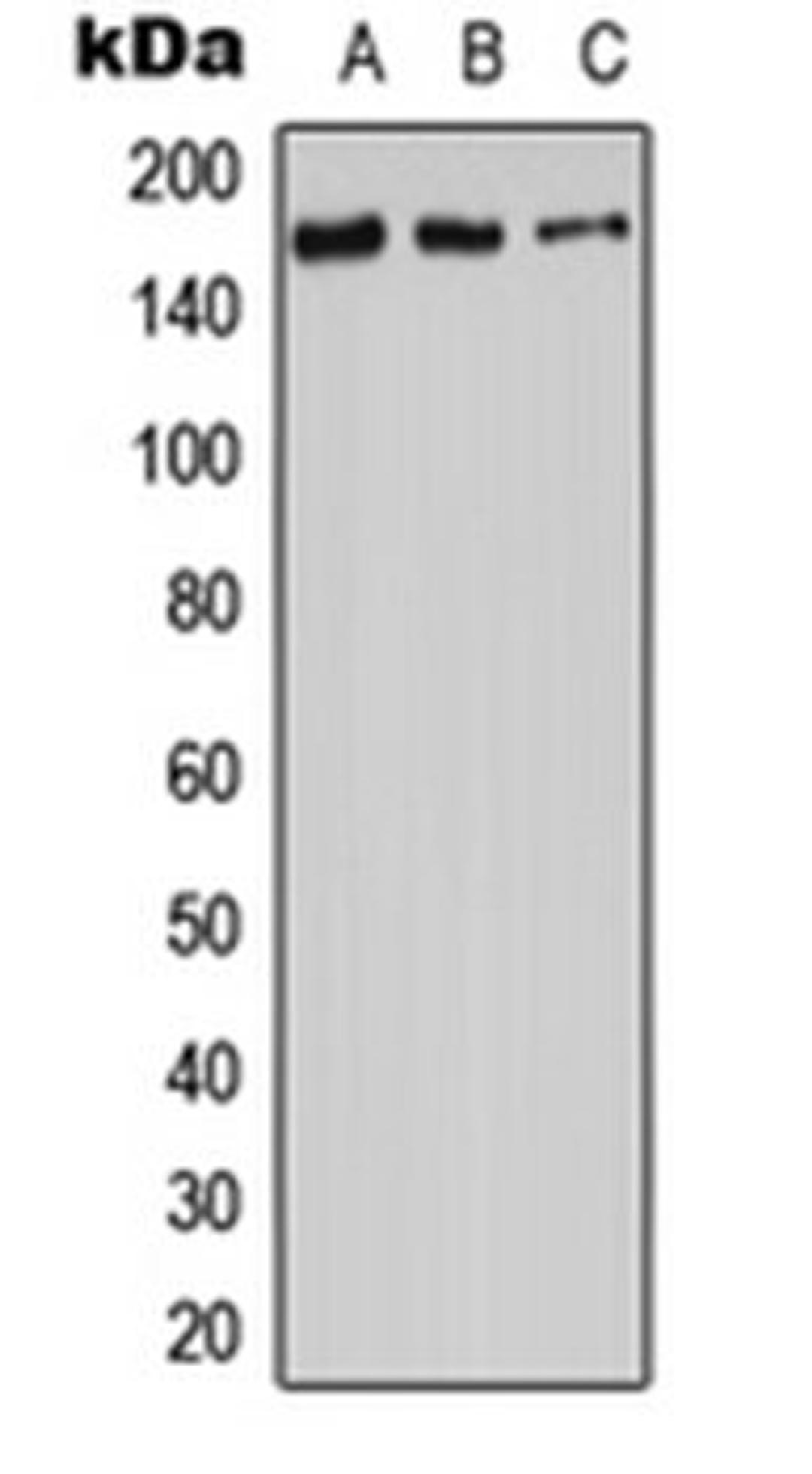 Western blot analysis of HeLa (Lane 1), SP2/0 (Lane 2), H9C2 (Lane 3) whole cell lysates using ADCY9 antibody